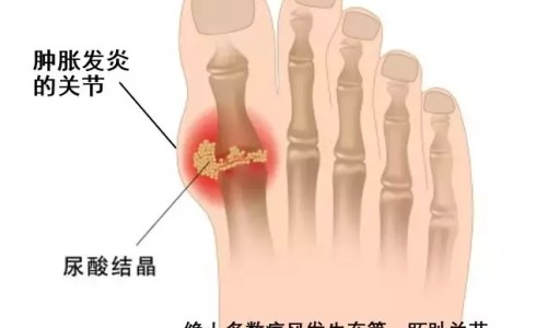血透室病人健康指导表-血透患者的健康宣教ppt专区_血透室健康宣教计划表专区_血透室病人健康指导网